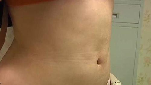 腹部抽脂视频,术前术后注意事项与效果展示