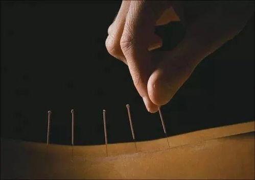 火针灸视频,视频带你领略传统中医魅力